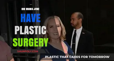 Mama June's Transformation: Plastic Surgery Rumors and Reality Revealed