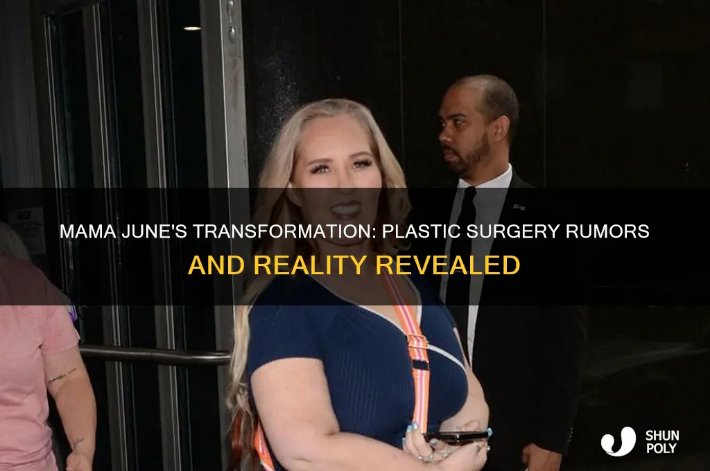 did mama june have plastic surgery