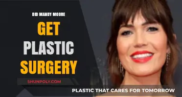 Mandy Moore's Transformation: Plastic Surgery Rumors Explored and Debunked