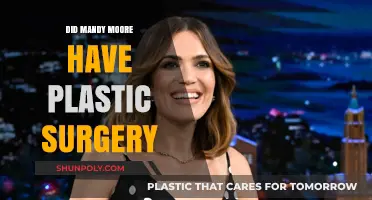 Mandy Moore Plastic Surgery: Fact-Checking the Rumors and Speculations