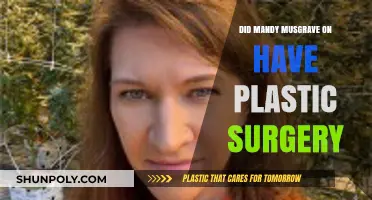 Mandy Musgrave's Transformation: Plastic Surgery Rumors Explored and Debunked