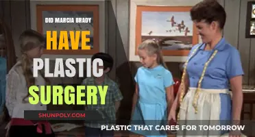 Unveiling Marcia Brady's Transformation: Plastic Surgery Speculations Explored