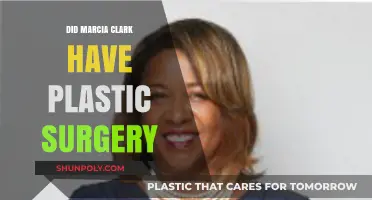 Marcia Clark's Transformation: Plastic Surgery Speculations and Truths Revealed