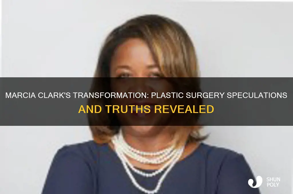 did marcia clark have plastic surgery