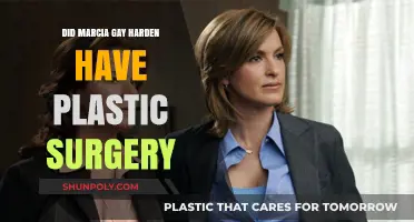 Marcia Gay Harden Plastic Surgery: Fact-Checking the Rumors and Speculations