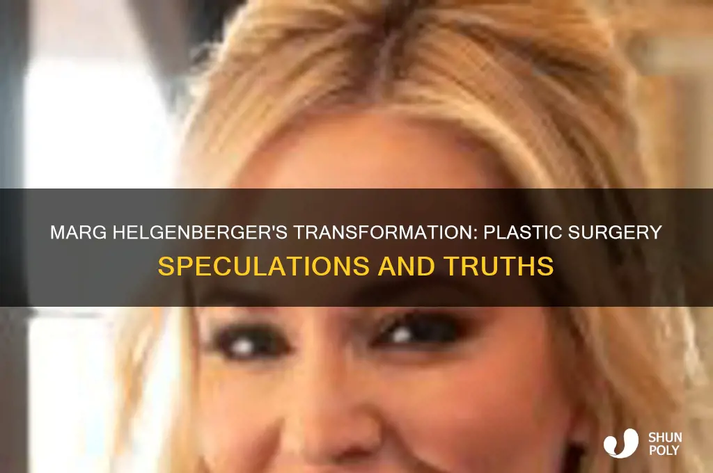 did marg helgenberger have plastic surgery
