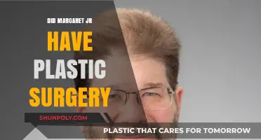 Margaret Jr's Transformation: Plastic Surgery Speculations and Truths Revealed