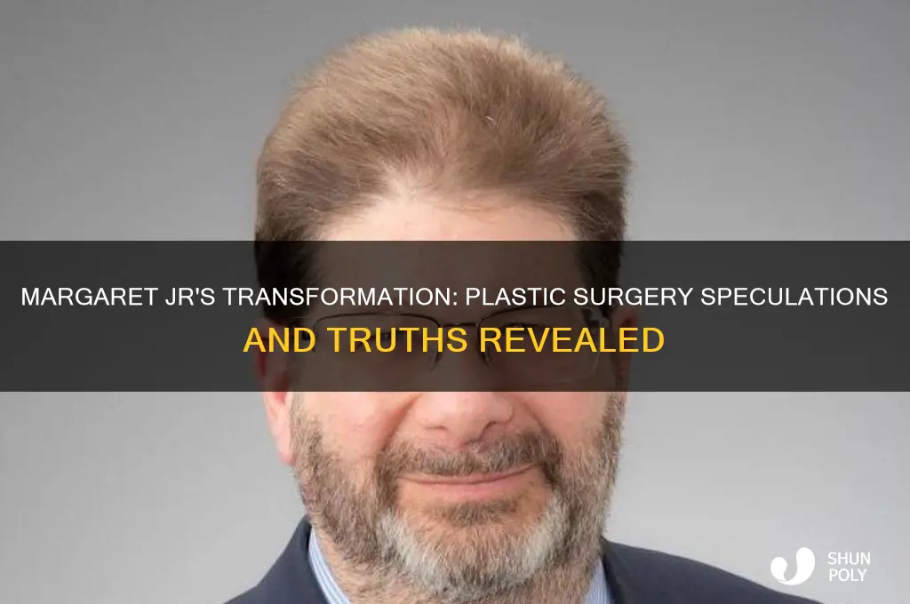 did margaret jr have plastic surgery