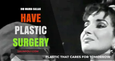 Maria Callas Plastic Surgery: Unraveling the Truth Behind the Rumors