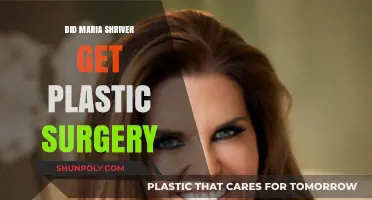 Maria Shriver's Transformation: Plastic Surgery Rumors Explored and Debunked