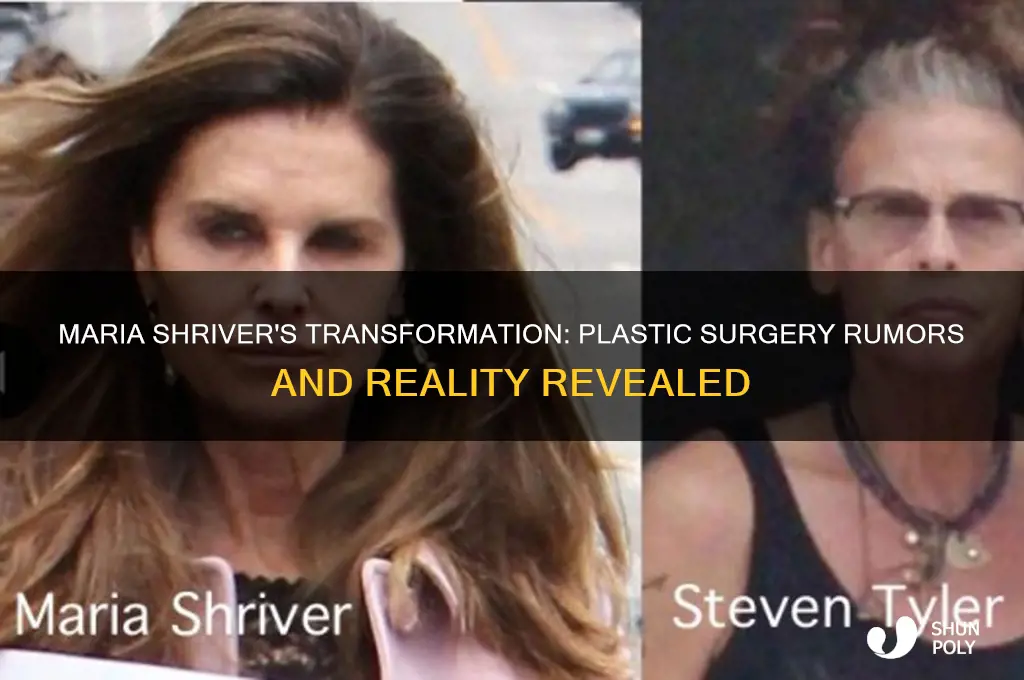 did maria shriver have plastic surgery