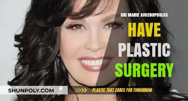 Marie Avgeropoulos Plastic Surgery: Fact-Checking the Rumors and Speculations