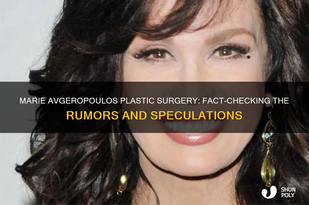did marie avgeropoulos have plastic surgery