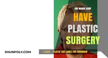 Marie Harf Plastic Surgery: Fact-Checking the Rumors and Speculations