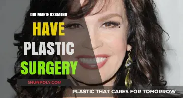 Marie Osmond's Transformation: Plastic Surgery Speculations and Truths Revealed