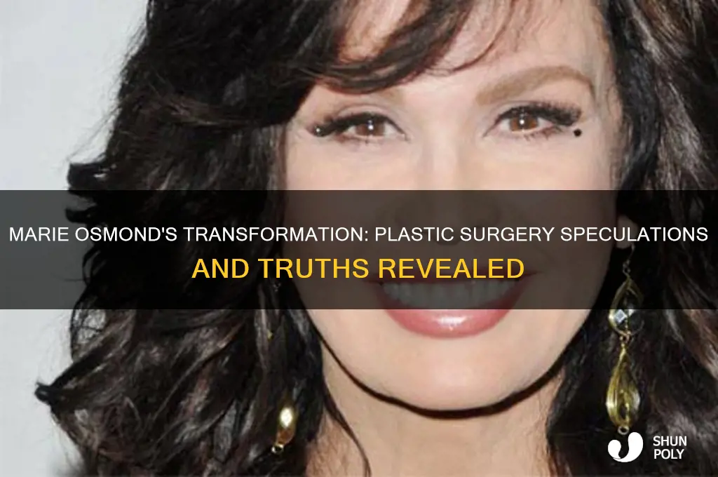 did marie osbmond have plastic surgery