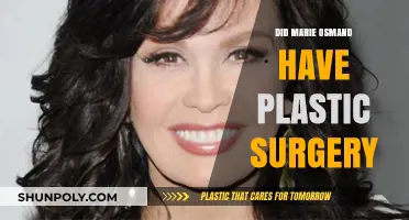 Marie Osmond's Transformation: Plastic Surgery Rumors and Reality Revealed