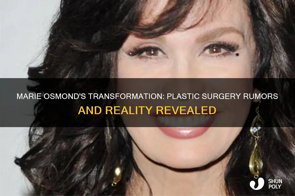 did marie osmand have plastic surgery