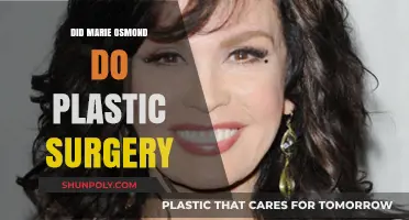 Marie Osmond's Transformation: Plastic Surgery Speculations and Truths Revealed