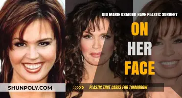 Marie Osmond's Facial Transformation: Plastic Surgery Speculations Explored