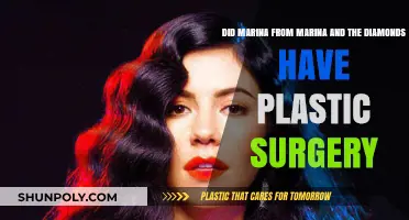 Did Marina Diamandis Undergo Plastic Surgery? Unraveling the Truth
