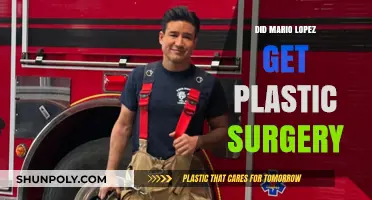 Mario Lopez Plastic Surgery: Fact or Fiction? Unveiling the Truth