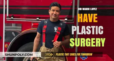 Mario Lopez Plastic Surgery: Fact or Fiction? Unveiling the Truth