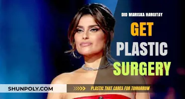 Mariska Hargitay's Transformation: Plastic Surgery Speculations and Truths