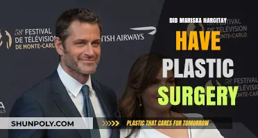 Mariska Hargitay's Transformation: Plastic Surgery Speculations Explored