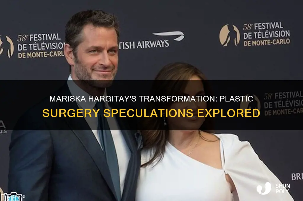 did mariska hargitay have plastic surgery