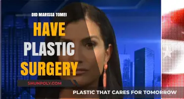 Marissa Tomei's Transformation: Plastic Surgery Rumors Explored