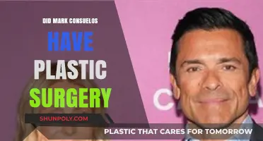 Mark Consuelos Plastic Surgery: Fact-Checking the Rumors and Speculations