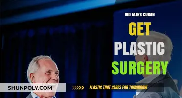 Mark Cuban's Transformation: Plastic Surgery Rumors Explored and Debunked