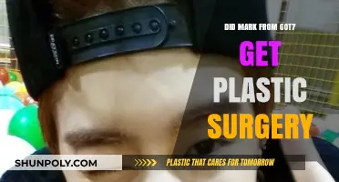 Did Mark from GOT7 Undergo Plastic Surgery? Unveiling the Truth