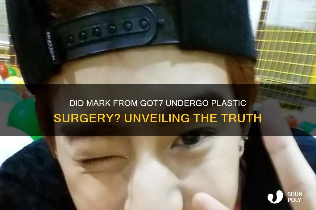 did mark from got7 get plastic surgery