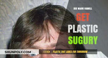 Did Mark Hamill Undergo Plastic Surgery? Unveiling the Truth