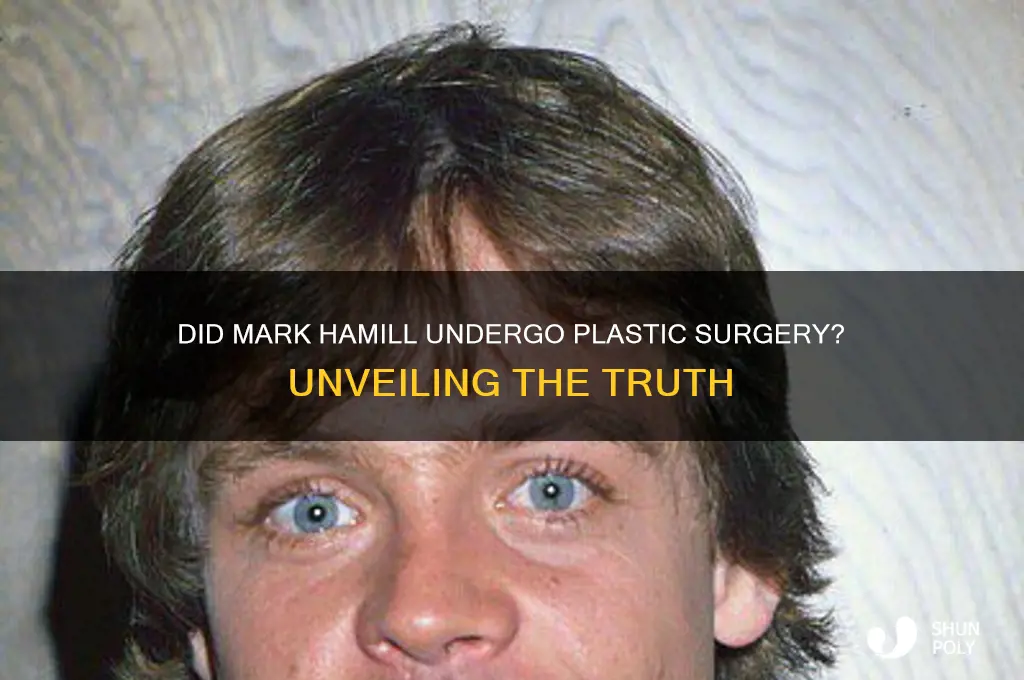 did mark hamill get plastic sugury