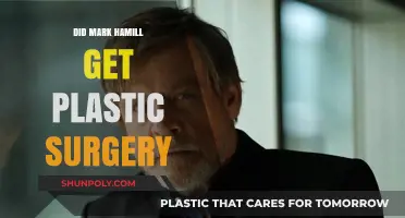 Mark Hamill Plastic Surgery: Fact or Fiction? Unveiling the Truth