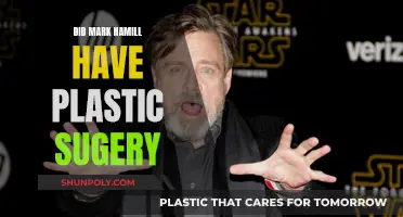 Plastic Surgery Speculations: Mark Hamill's Transformation