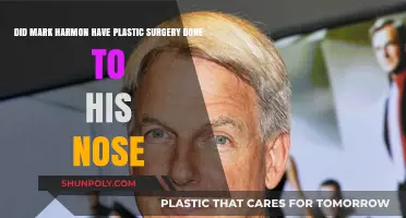 Mark Harmon's Nose Transformation: Plastic Surgery Speculations Explored