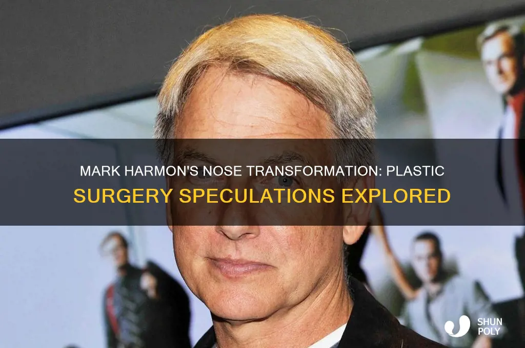did mark harmon have plastic surgery done to his nose
