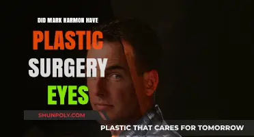 Mark Harmon's Eye Transformation: Plastic Surgery Speculations Explored