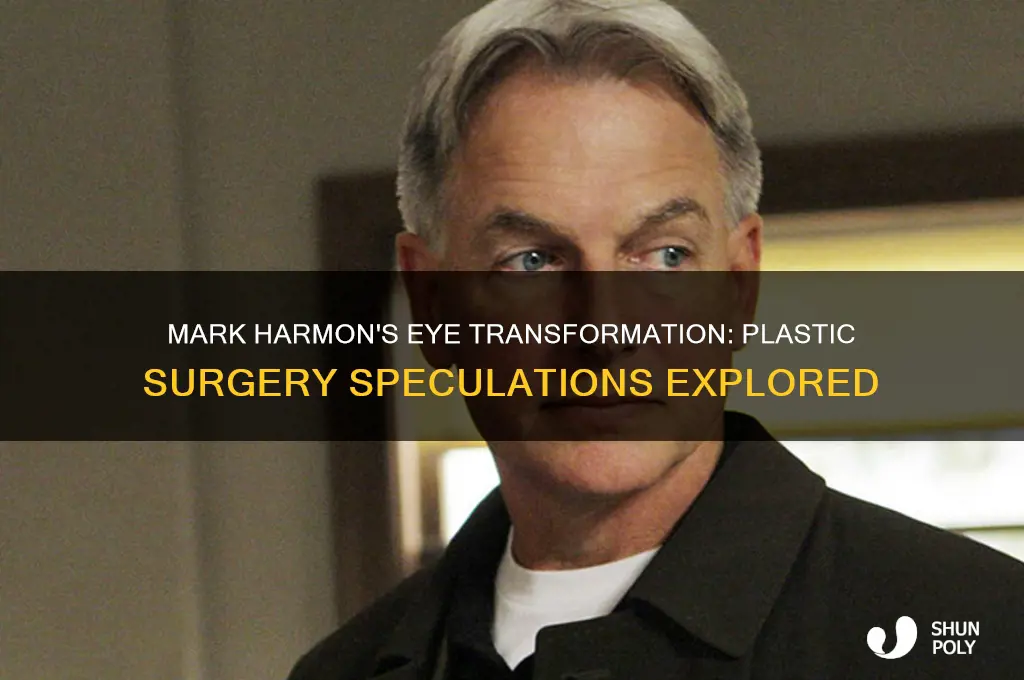 did mark harmon have plastic surgery eyes