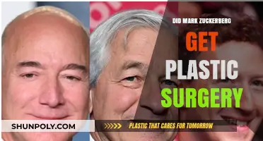 Mark Zuckerberg Plastic Surgery Rumors: Fact or Fiction?