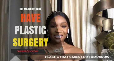 Marlo Hampton's Transformation: Plastic Surgery Rumors on RHOA Explored