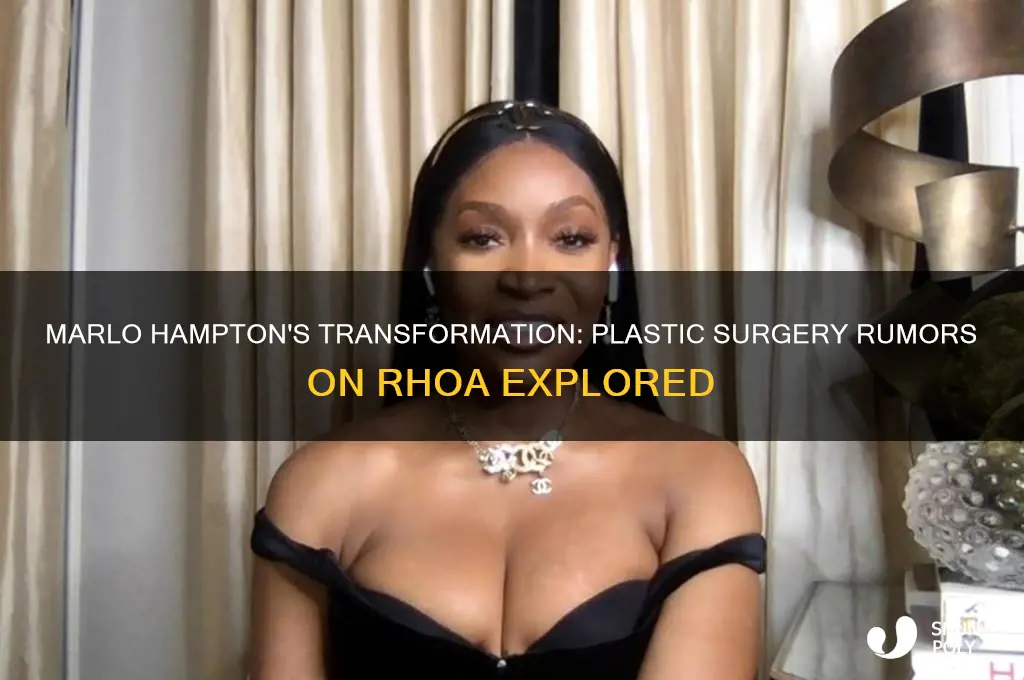 did marlo of rhoa have plastic surgery