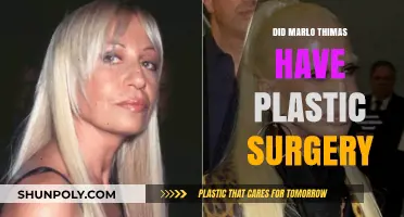 Marlo Thomas Plastic Surgery: Fact-Checking the Rumors and Speculations