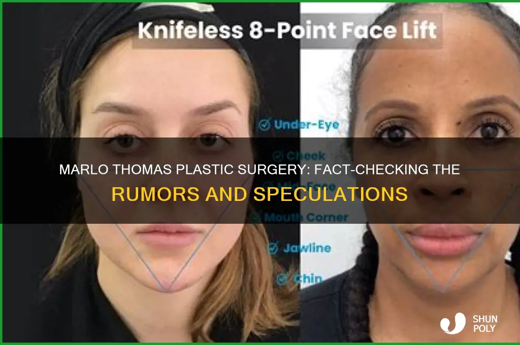 did marlo thimas have plastic surgery