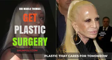 Marlo Thomas Plastic Surgery: Fact-Checking the Rumors and Speculations