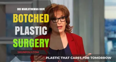 Marlothomas Plastic Surgery: Botched or Misunderstood Transformation?